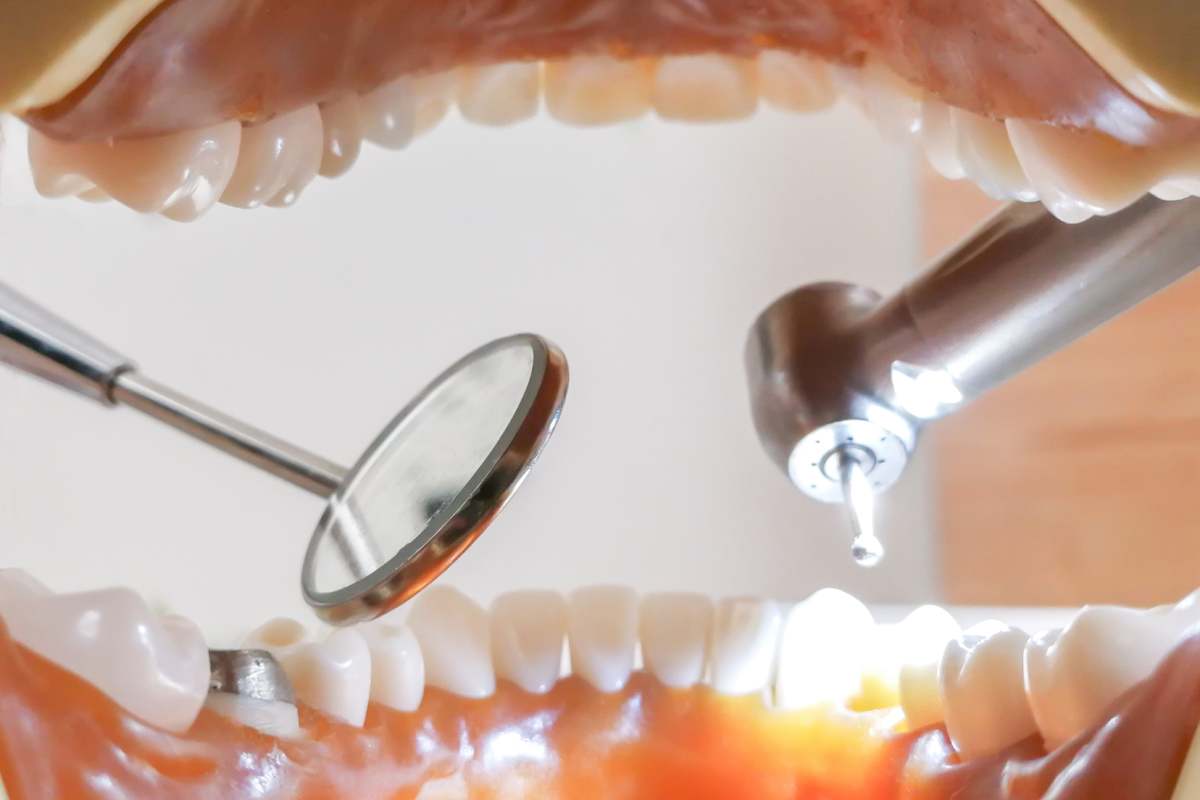 Images of Dental Treatment at a Japanese Dentist's Office